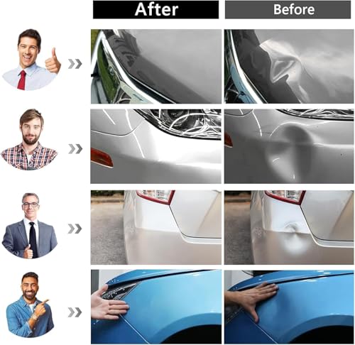Auto Paintless Dent Removal Kit – Adjustable Paintless Dent Repair Tool for Auto, Motorcycle, & Metal Surfaces, Complete Car Dent Puller kit Quick Fix for Small & Large Dings, Hail Damage