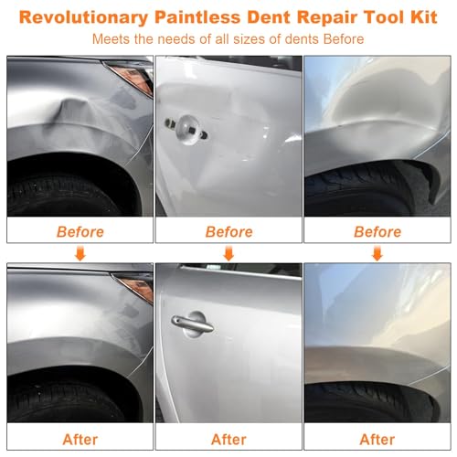 97PCS Dent Puller Kit, Paintless Dent Removal Kit for Dent Repair, Car Dent Repair Kit with Golden Lifter, Slide Hammer T-Bar, Bridge Puller, Car Dent Puller for Car Refrigerator Door Ding Repair