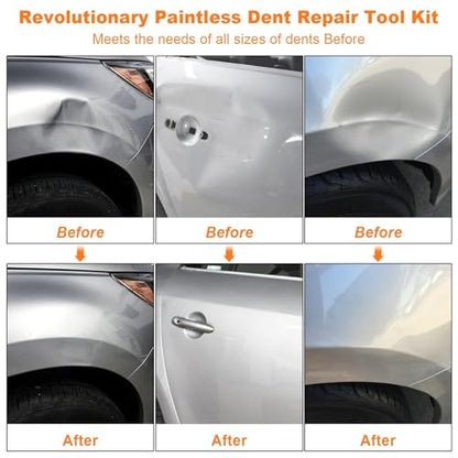 97PCS Dent Puller Kit, Paintless Dent Removal Kit for Dent Repair, Car Dent Repair Kit with Golden Lifter, Slide Hammer T-Bar, Bridge Puller, Car Dent Puller for Car Refrigerator Door Ding Repair