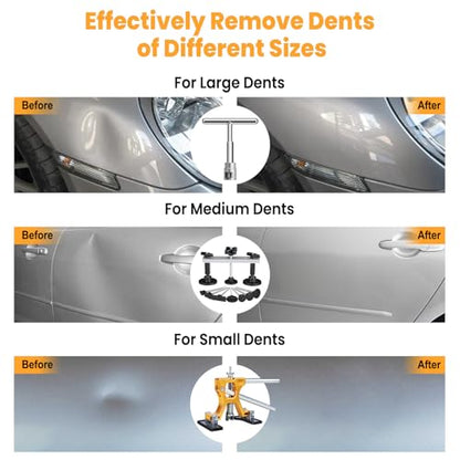 Sigoobal Car Dent Puller Kit, 135pcs Paintless Dent Removal Kit, Car Dent Repair Kit with Golden Lifter, Bridge Puller, Slide Hammer 2 in 1 T-Bar, Dent Puller for Car Refrigerator Door Ding Repair