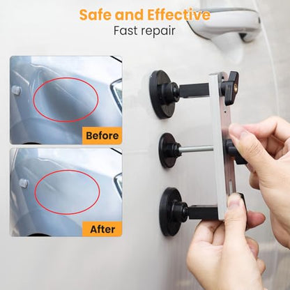 Sigoobal Car Dent Puller Kit, 135pcs Paintless Dent Removal Kit, Car Dent Repair Kit with Golden Lifter, Bridge Puller, Slide Hammer 2 in 1 T-Bar, Dent Puller for Car Refrigerator Door Ding Repair