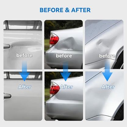 Dent Puller Kit for Car for Auto Body Dent Repair Door Dings and Creases | Adjustable PDR Tools,Paintless Repair Dent Kit,DIY Body Repair,Door Dings,Easy to Use for Both Beginners and Professionals