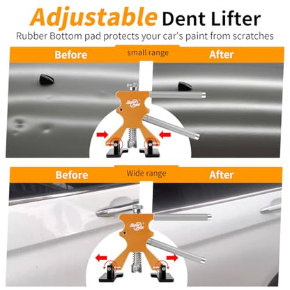 Super PDR Paintless Dent Repair Kit 148PCS Dent Puller Kit with LED Light Board Can Removal 99% of Car Dents in 30 Minutes for Repair Work of Big Dents, Small Dents, Door Ding, Creases and Hail Damage