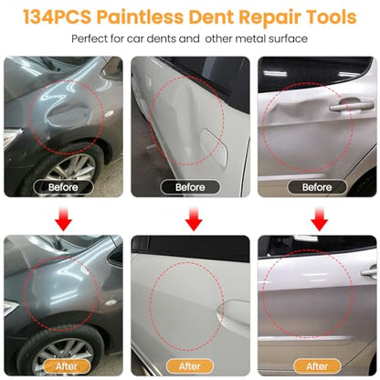 Sigoobal Dent Puller, 134PCS Paintless Dent Removal Kit – Car Dent Puller Kit with Slide Hammer 2 in 1 T-Bar, Golden Lifter, Bridge Puller–Dent Remover Tool for Car Hail, Dings Damage DIY Repair