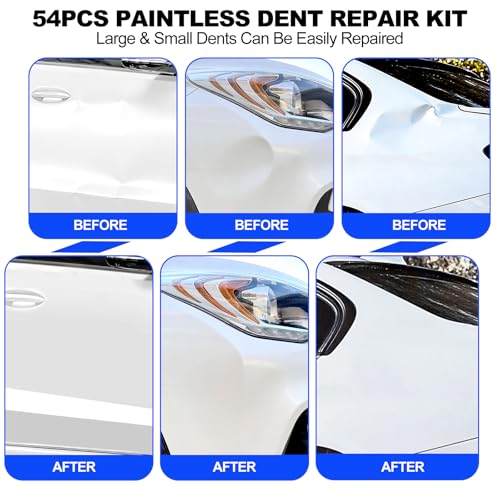116PCS Car Dent Puller Kit, PDR Tool Kit with Glue Gun, Suction Cups, Bridge Puller & T-Bar Puller, Paintless Dent Repair for Trucks, SUVs, Complete Auto Body Tools for Shop & Advanced DIY User