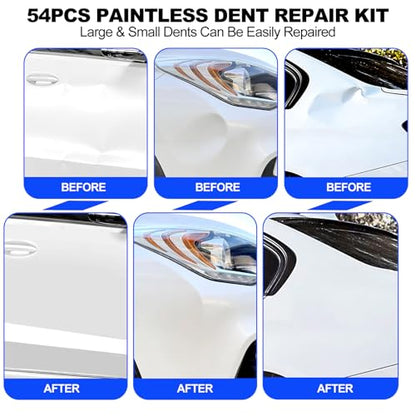 116PCS Car Dent Puller Kit, PDR Tool Kit with Glue Gun, Suction Cups, Bridge Puller & T-Bar Puller, Paintless Dent Repair for Trucks, SUVs, Complete Auto Body Tools for Shop & Advanced DIY User