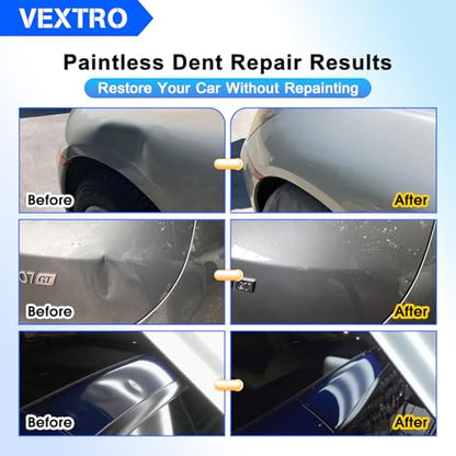 VEXTRO Paintless Dent Repair Kit, Dent Puller kit,Dent Removal Tools with Metal Dent Lifter, Bridge Puller, Slide Hammer T-Bar, PDR Kit for Car Dent Repair, Auto Body Dent Puller, Hail Damage Removal