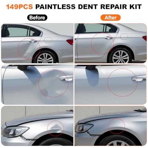 Dent Puller, 149PCS Paintless Dent Removal Kit – Car Dent Puller Kit with Slide Hammer 2 in 1 T-Bar, Lifter, Bridge Puller–Dent Remover Tool for Car Hail Dent Remove Repairs 95% of Car Dents