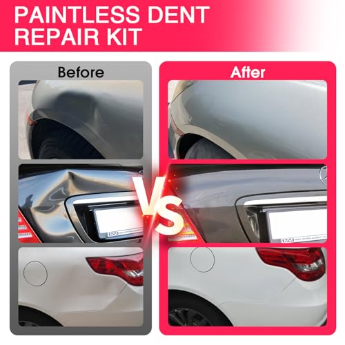 VEXTRO Dent Puller Kit, Dent Removal Kit for Car Auto Body - Paintless Dent Repair with Slide Hammer, Dent Puller Tabs for Hail Damage, Door Dings, Auto Dent Pulling and Car Dent Repair - size: PDR kit -2