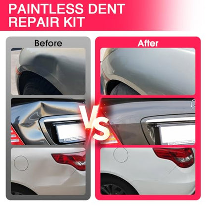 VEXTRO Dent Puller Kit, Dent Removal Kit for Car Auto Body - Paintless Dent Repair with Slide Hammer, Dent Puller Tabs for Hail Damage, Door Dings, Auto Dent Pulling and Car Dent Repair - size: PDR kit -2