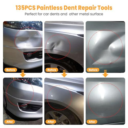 Sigoobal Car Dent Puller Kit, 135pcs Paintless Dent Removal Kit, Car Dent Repair Kit with Golden Lifter, Bridge Puller, Slide Hammer 2 in 1 T-Bar, Dent Puller for Car Refrigerator Door Ding Repair