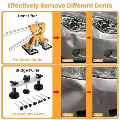 Sigoobal Dent Puller, 134PCS Paintless Dent Removal Kit – Car Dent Puller Kit with Slide Hammer 2 in 1 T-Bar, Golden Lifter, Bridge Puller–Dent Remover Tool for Car Hail, Dings Damage DIY Repair